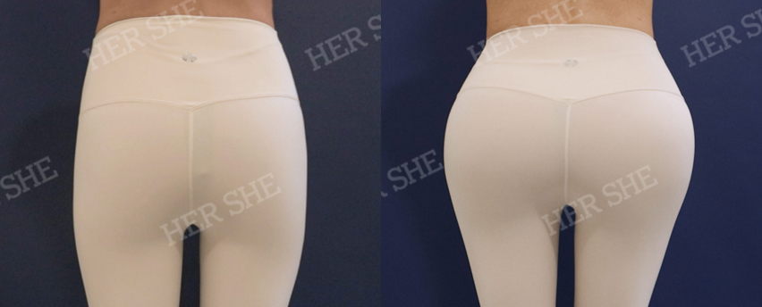BEFORE & AFTER