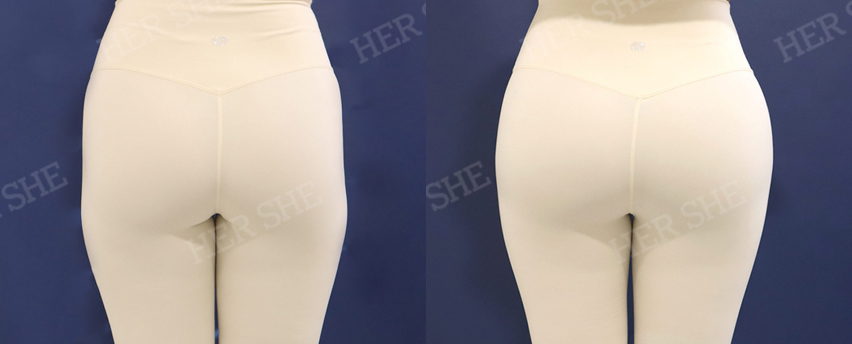 BEFORE & AFTER