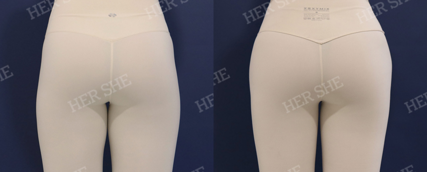 BEFORE & AFTER