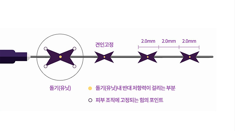히알루론산 필러 이미지