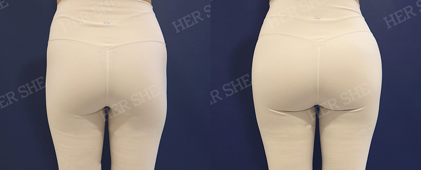 BEFORE & AFTER