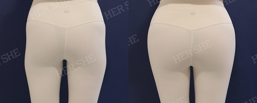 BEFORE & AFTER